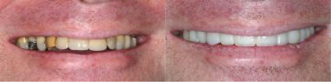 Dr. Cohen before and after